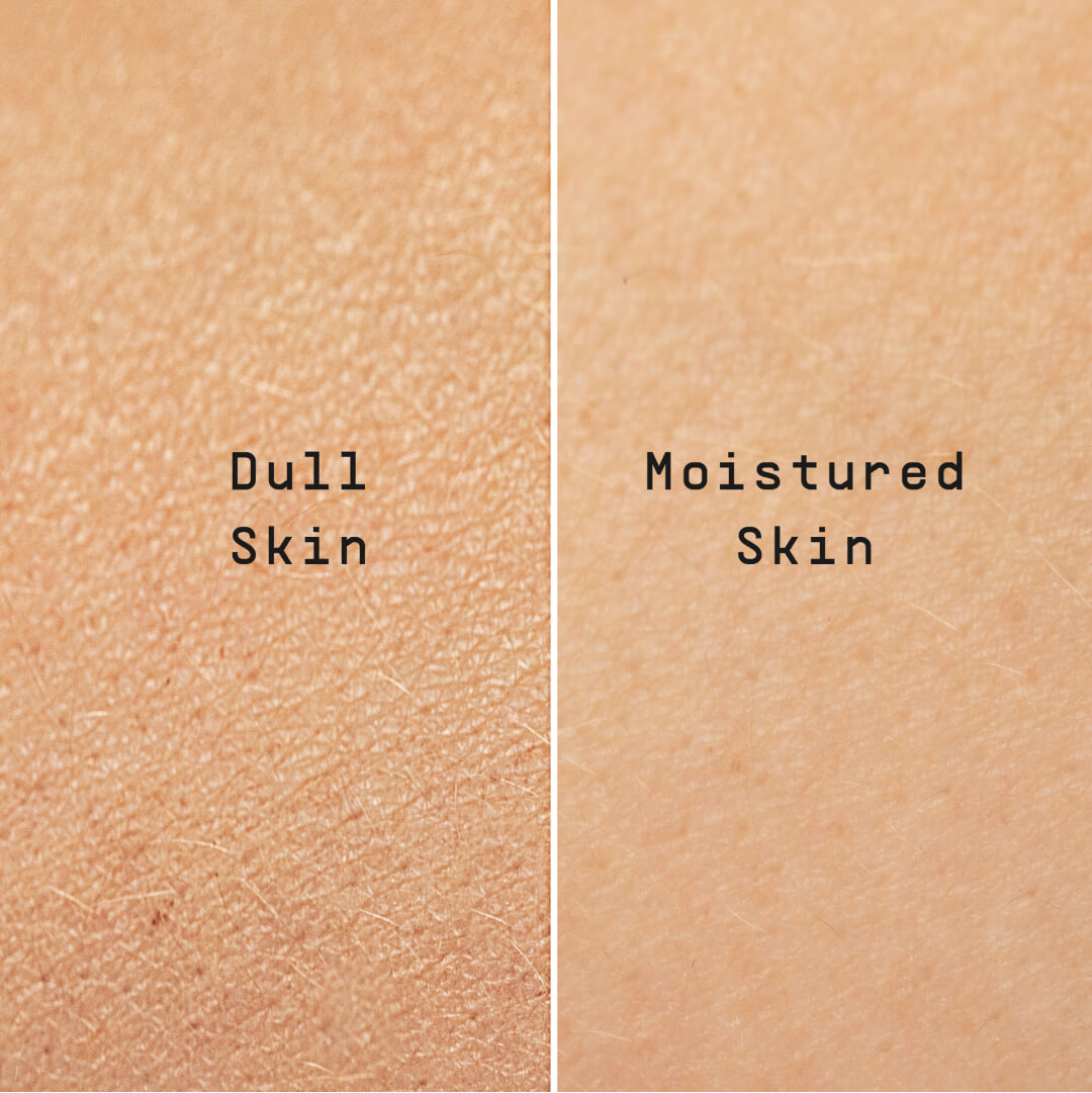Side by side comparison of skin when Busy Beauty wipes are used: Dull skin on the left and Moisturized skin on the right